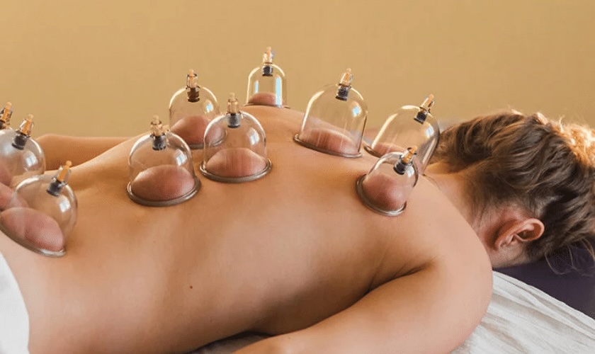 Cupping thumbnail